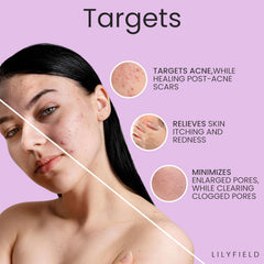 Glow Serum, Smoothen Acne, Pigmentation & Spots. Enlarged Pores, Uneven Skin Tone, Brighten, for Sensitive Skin, Korean Skin care, Makeupstashpk