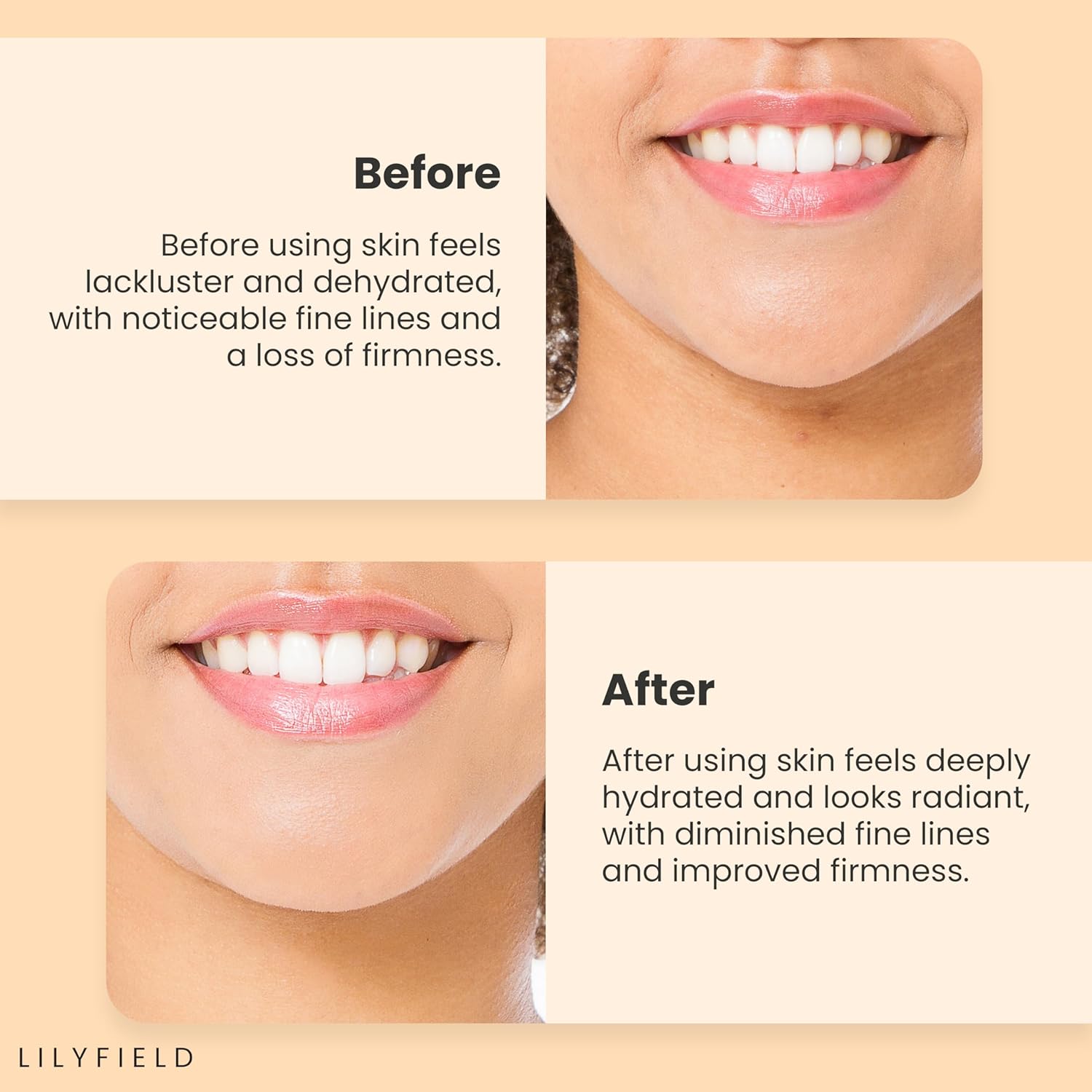 Wrinkle repair serum, Firming serum , Plumping serum , skin tightening serum ,Collagen face serum , korean skincare , Makeupstashk
