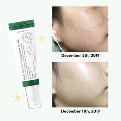 5% Niacinamide , Mini Brightening Serum , Dark Spot , Glow Serum , Makeupstashpk