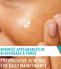 CeraVe Blemish Control Gel 40ml – Salicylic Acid Acne Treatment & Pore Refining Gel
