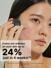 COSRX The Niacinamide 15 Serum 20ML – 15% Niacinamide Serum for Pores, Acne & Oil Control