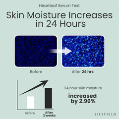 Heartleaf serum, Calming serum, Soothing serum, Anti redness serum, korean skincare serum, Sensitive skin serum, Acne calming serum, Houttuynia cordata serum, k beauty serum, Skin Soothing treatment, Makeupstashpk