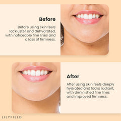 Wrinkle repair serum, Firming serum , Plumping serum , skin tightening serum ,Collagen face serum , korean skincare , Makeupstashk