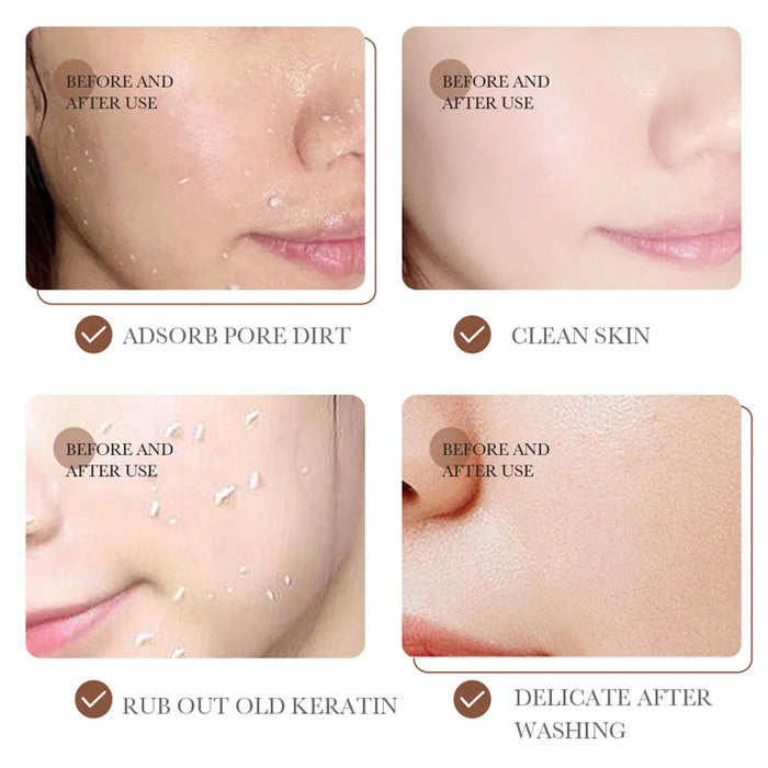 BioAqua Exfoliating Gel Body Cream – Smooth & Bright Skin