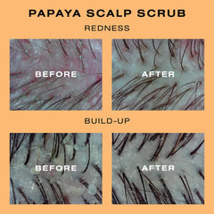  Exfoliating ,Detoxifying ,Treatment , Hair Care , Makeup Stash Pakistan